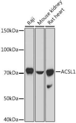 Western Blot: ACSL1 AntibodyAzide and BSA Free [NBP2-92757]